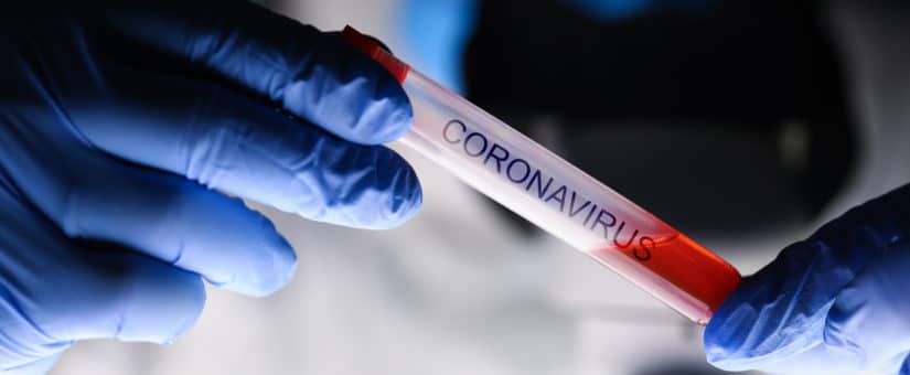 Ocho nuevos fallecidos por coronavirus en el país, llegan a 656 las muertes.
